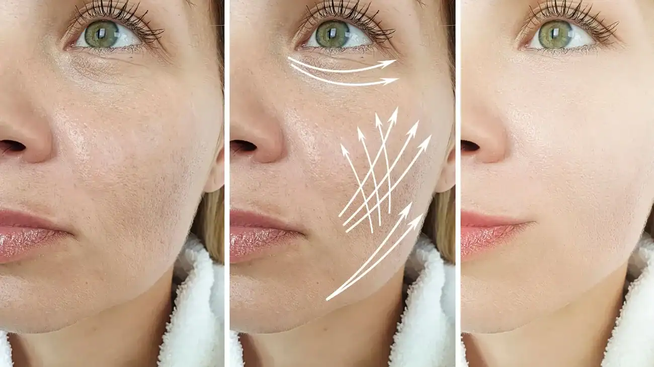 Can One Treatment Really Tackle More Than One Skin Concern Rowley Regis?