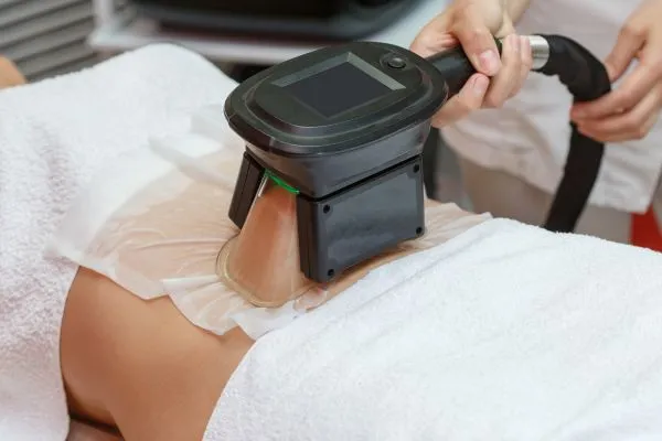 Image of person having fat freezing treatment to help weight gain Rowley Regis