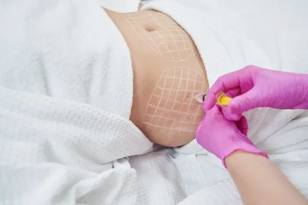 image of fat dissolving injections on love handles to help combat weight gain Rowley Regis