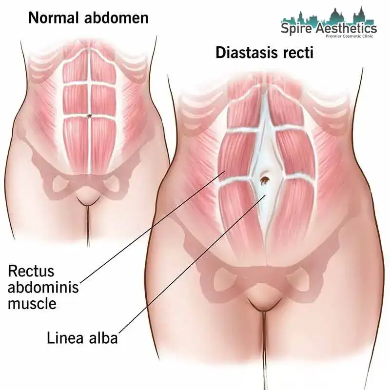 When Will My Belly Feel Normal Again Rowley Regis?