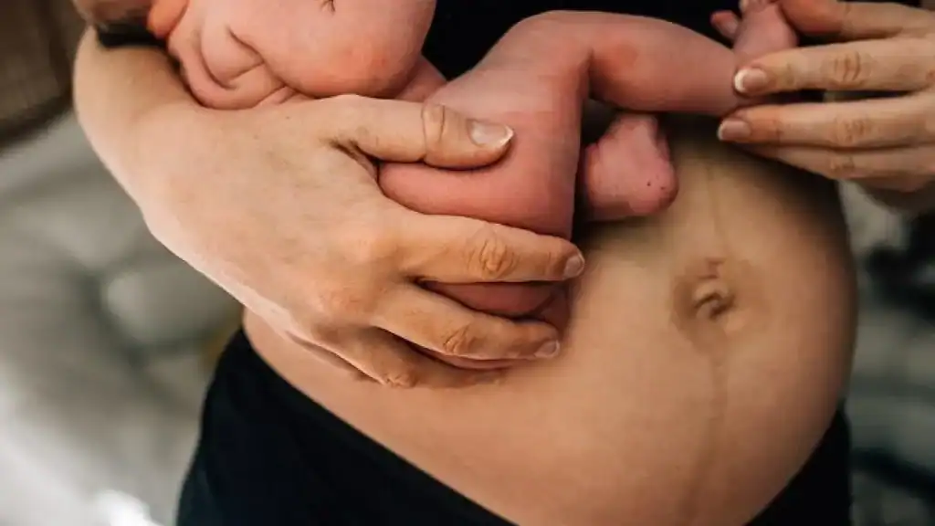 Why Is My Stomach Still Big After Pregnancy Rowley Regis?
