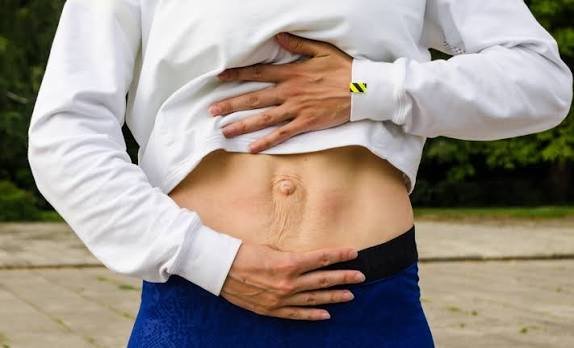 When Could Diastasis Recti Be the Missing Piece of the Puzzle Rowley Regis?